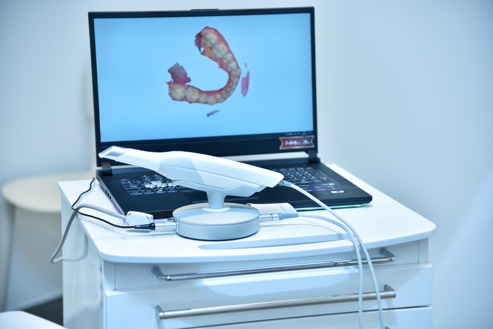 3SHAPE TRIOS digital scanner